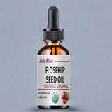 Load image into Gallery viewer, Pure Rosehip Essential Oil