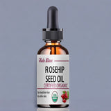 Load image into Gallery viewer, Pure Rosehip Essential Oil